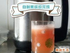 外伤出血的止血方法首选