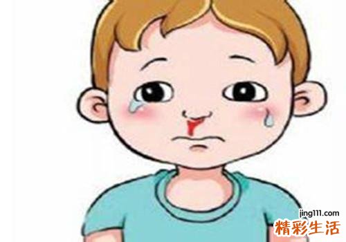 流鼻血和血压有关系吗 鼻出血止血的方法