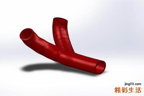 血管保养方法 什么导致血管老化