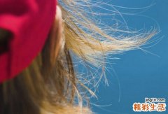 夏季掉发严重怎么办