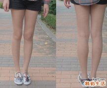 打瘦腿针能维持多久