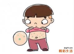 小儿过敏性紫癜的护理 小儿过敏性紫癜的症状特点
