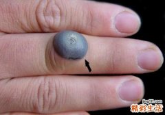 瘊子冷冻后的水泡能弄破么