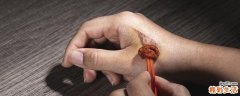 被开水烫伤的疤痕能消吗 被开水烫伤能用碘酒吗