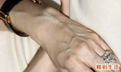 青筋明显是什么原因？99%的人不知道青筋凸起与这些病有关