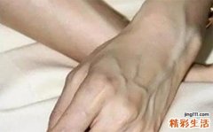 青筋暴起是什么原因 这4个部位你要注意