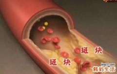 血管弹性差怎么改善 怎么增加血管弹性