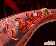 吃什么恢复血管弹性 恢复血管弹性方法