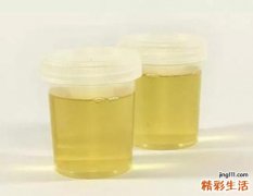 怎么从尿液看健康状况 这9种你要警惕
