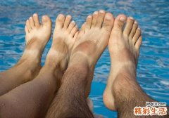 脚趾甲变厚怎么回事 脚趾甲又厚又硬怎么办