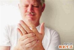 手脚麻木是什么原因引起的 2招挥别手麻