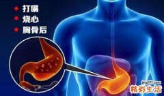 反酸怎么办 反酸必须注意这3点