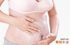 孕妇肚皮痒可以涂什么
