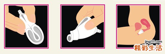 女性卫生用品有哪些？处女能用“月经杯”吗？