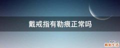 戴戒指有勒痕正常吗