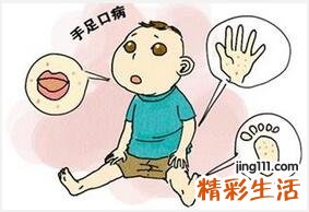 儿童手足口病的日常预防和中医小偏方
