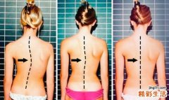 这种病夏天最容易发现！尤其是女性一定要注意