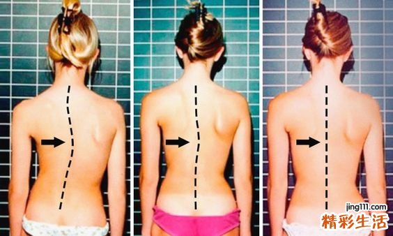 这种病夏天最容易发现!尤其是女性一定要注意