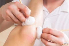 糖尿病患者不宜戴隐形眼镜