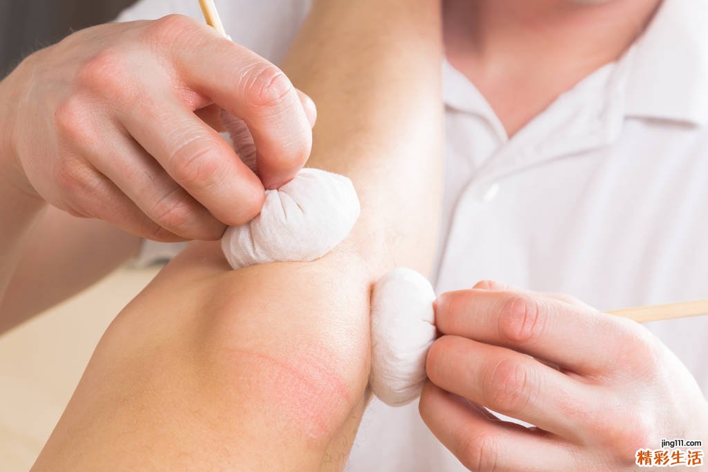 糖尿病患者不宜戴隐形眼镜