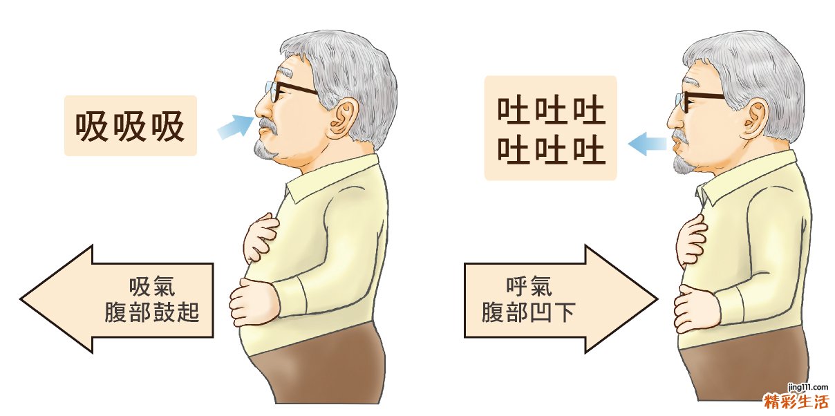 逆腹式呼吸辅助治疗肺部疾病