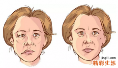 夏日贪凉，“面瘫”易发非小事！