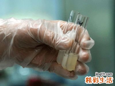 精液长期发黄莫忽视
