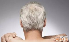 头发变白八个原因 怎么才能让头发重返乌黑亮丽？