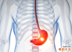 胃癌，为什么患病率这么高？竟然跟它有关……