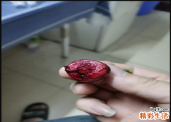 如何挑选樱桃