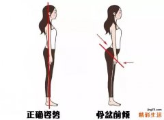 产后形体大揭秘