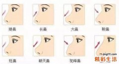 鼻当家为您解答鼻部整形失败怎么办？