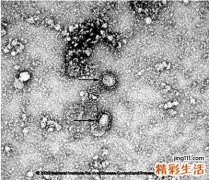 《柳葉刀》發(fā)布新型冠狀病毒研究論文，已出現(xiàn)第四代傳播者