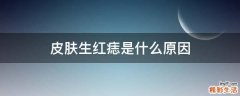 皮肤生红痣是什么原因