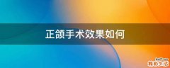 正颌手术效果如何