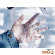 急慢性肝炎怎么调理