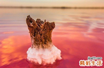 色素性紫癜性皮病的概述