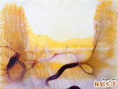 乳酸菌与腹泻的关系